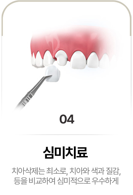 심미치료