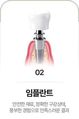 임플란트