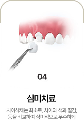 심미치료