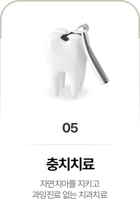 충치치료