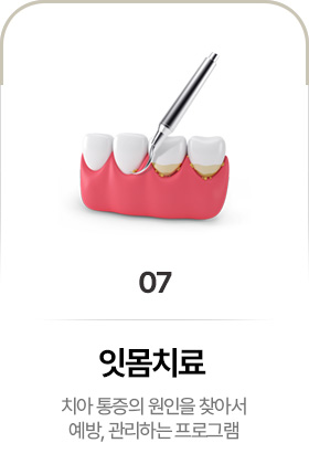 잇몸치료