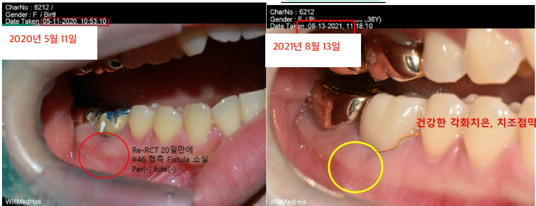 %25ED%2599%2594%25EB%25A9%25B4%2B%25EC%25BA%25A1%25EC%25B2%2598%2B2025-09-06%2B210740.png